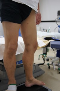 下肢静脈瘤　研修映像撮影制作　九州　福岡　東京 弊社では数多くのドクター向け　患者様向け　ビデオ映像を制作制作しております。 お気軽にご相談ください。 092-623-7002 https://sotry.jp